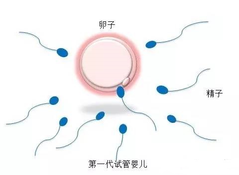 男性不妊